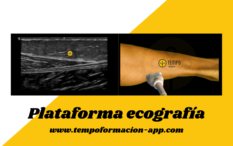 3. Preguntas y respuestas ecografia fascitis plantar delgado plantar osgood schlatter.png